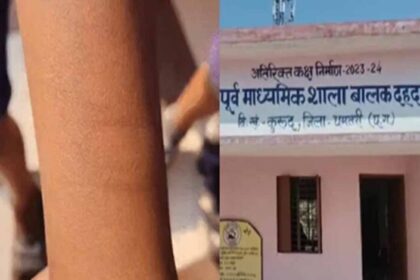 cg-के-स्कूल-में-छात्र-ने-एक-दर्जन-सहपाठियों-को-काटा,-स्वास्थ्य-विभाग-की-टीम-पहुंची-जांच-में